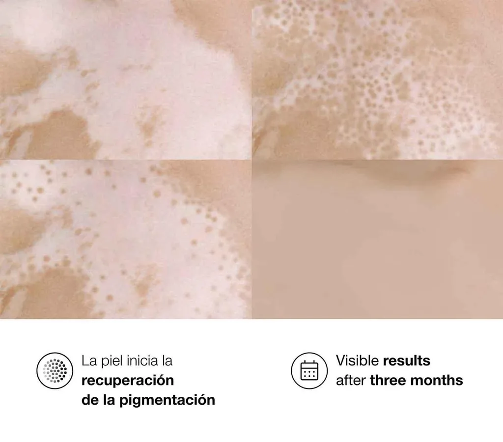BELLA AURORA REPIGMENT12 CREME 75ML-4.webp